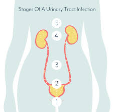 why do i keep getting urine infections
